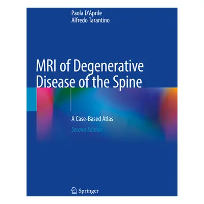 "MRI of Degenerative Disease of the Spine: A Case-Based Atlas" - "" ("D'Aprile Paola")(Paperback