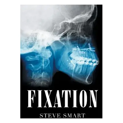 "Fixation" - "" ("Smart Steve")(Pevná vazba)