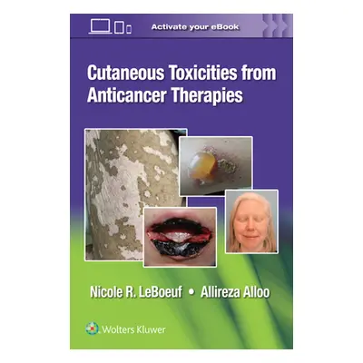 "Cutaneous Reactions from Anti-Cancer Therapies" - "" ("Alloo Allireza")(Paperback)