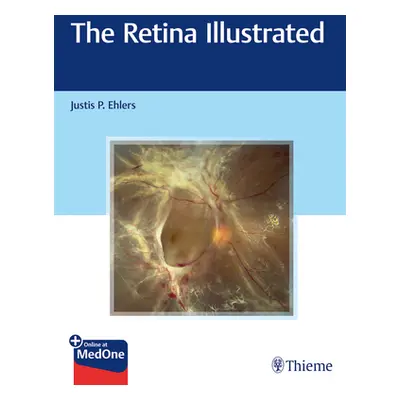 "The Retina Illustrated" - "" ("Ehlers Justis P.")(Paperback)