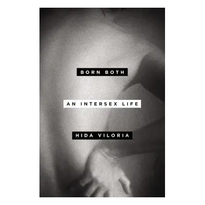 "Born Both: An Intersex Life" - "" ("Viloria Hida")(Pevná vazba)