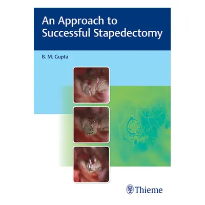 "An Approach to Successful Stapedectomy" - "" ("Gupta B.")(Pevná vazba)