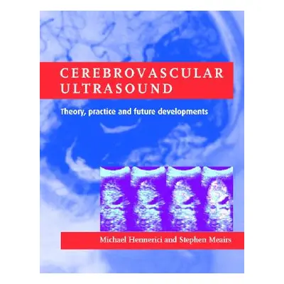 "Cerebrovascular Ultrasound" - "Theory, Practice and Future Developments" ("")(Pevná vazba)