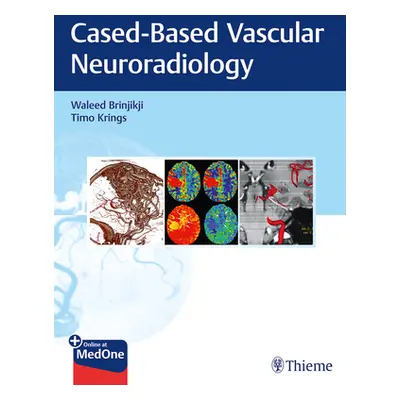 "Imaging in Neurovascular Disease: A Case-Based Approach" - "" ("Brinjikji Waleed")(Paperback)