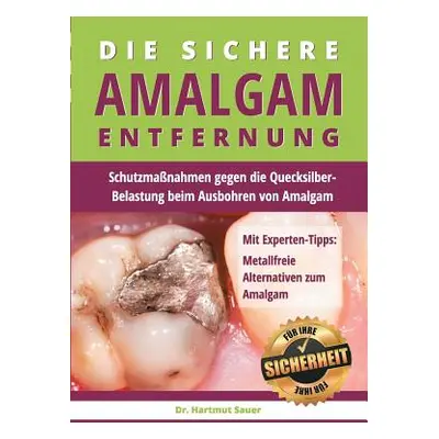 "Die sichere Amalgam-Entfernung: Schutzmanahmen gegen die Quecksilber-Belastung beim Ausbohren v