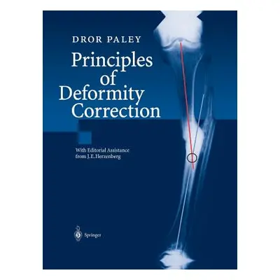 "Principles of Deformity Correction" - "" ("Herzenberg J. E.")(Paperback)