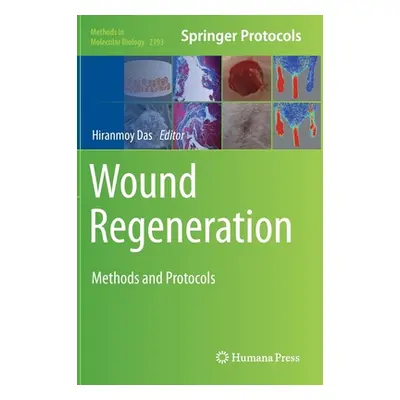 "Wound Regeneration: Methods and Protocols" - "" ("Das Hiranmoy")(Pevná vazba)