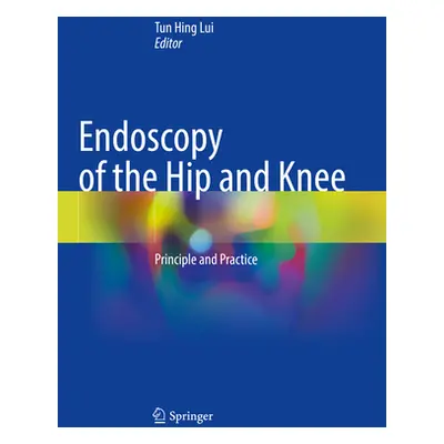 "Endoscopy of the Hip and Knee: Principle and Practice" - "" ("Lui Tun Hing")(Paperback)