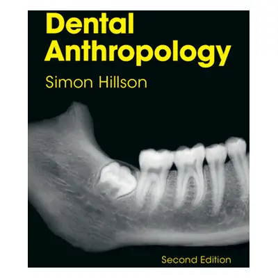 "Dental Anthropology" - "" ("Hillson Simon (University College London)")(Paperback / softback)