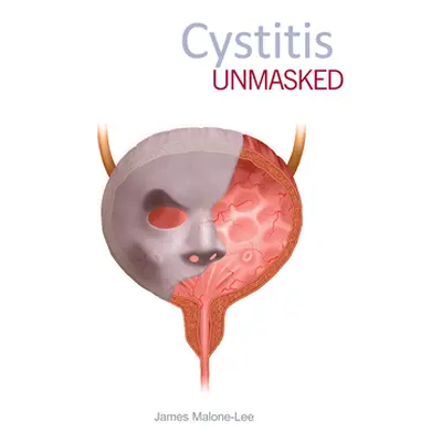 "Cystitis Unmasked" - "" ("Malone-Lee James")(Paperback)