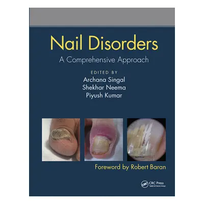 "Nail Disorders: A Comprehensive Approach" - "" ("Singal Archana")(Paperback)