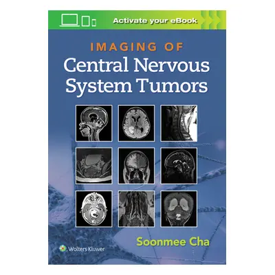 "Imaging of Central Nervous System Tumors" - "" ("Cha Soonme")(Pevná vazba)