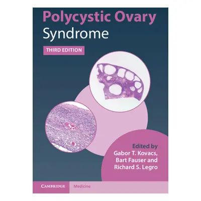 "Polycystic Ovary Syndrome" - "" ("")(Pevná vazba)