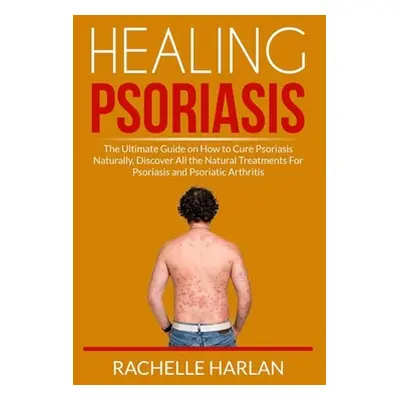 "Healing Psoriasis: The Ultimate Guide on How to Cure Psoriasis Naturally, Discover All the Natu