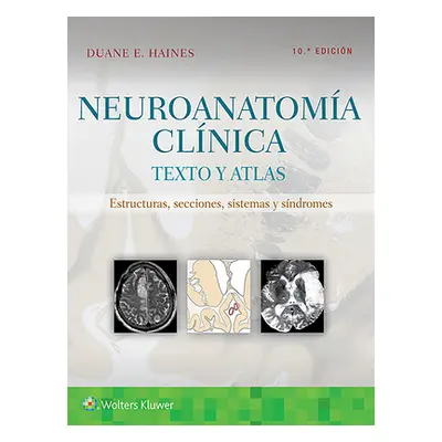 "Neuroanatoma Clnica: Texto Y Atlas" - "" ("Haines Duane E.")(Paperback)