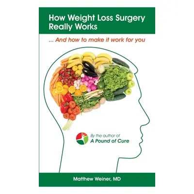 "How Weight Loss Surgery Really Works: And How to Make it Work for You" - "" ("Weiner MD Matthew