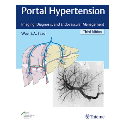 "Portal Hypertension: Imaging, Diagnosis, and Endovascular Management" - "" ("Saad Wael E. a.")(