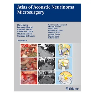 "Atlas of Acoustic Neurinoma Microsurgery" - "" ("Sanna Mario")(Pevná vazba)