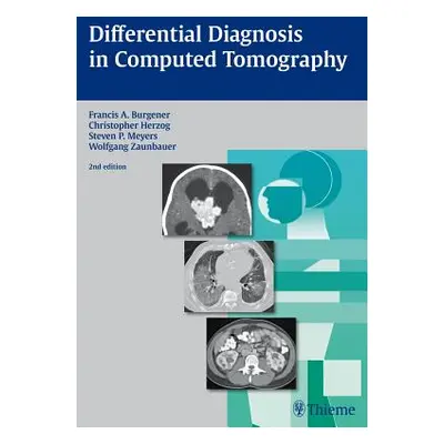 "Differential Diagnosis in Computed Tomography" - "" ("Burgener Francis A.")(Pevná vazba)