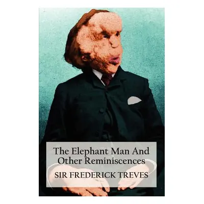 "The Elephant Man and Other Reminiscences" - "" ("Treves Frederick")(Paperback)