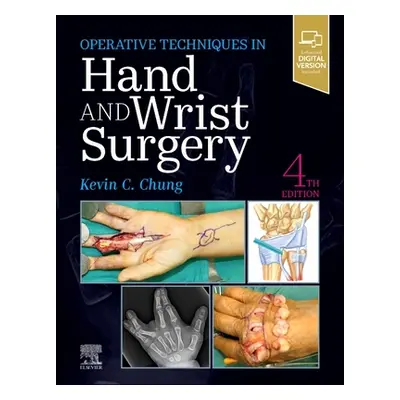 "Operative Techniques: Hand and Wrist Surgery" - "" ("Chung Kevin C.")(Pevná vazba)