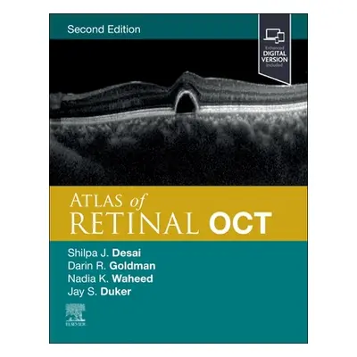 "Atlas of Retinal Oct: Optical Coherence Tomography" - "" ("Duker Jay S.")(Pevná vazba)