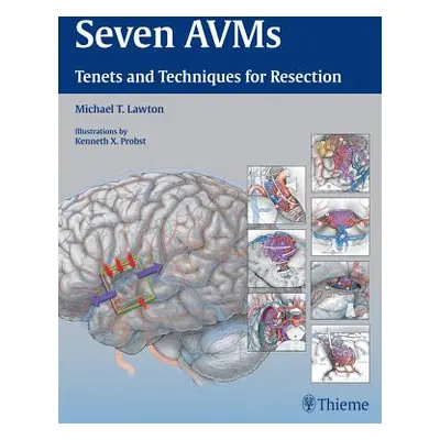 "Seven Avms: Tenets and Techniques for Resection" - "" ("Lawton Michael T.")(Pevná vazba)