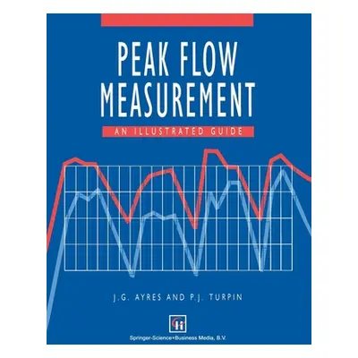 "Peak Flow Measurement: An Illustrated Guide" - "" ("Ayres J. G.")(Paperback)