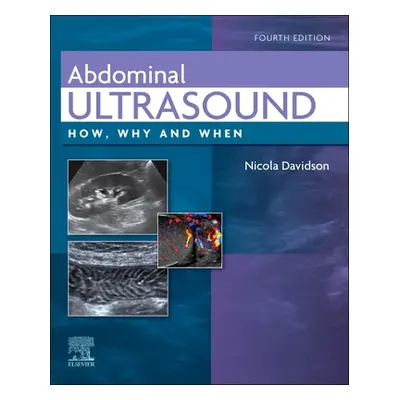 "Abdominal Ultrasound: How, Why and When" - "" ("Davidson Nicola")(Pevná vazba)