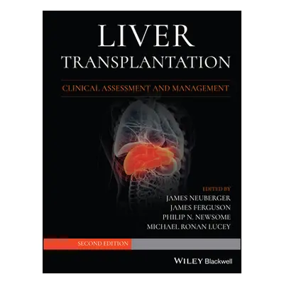 "Liver Transplantation: Clinical Assessment and Management" - "" ("Neuberger James")(Pevná vazba