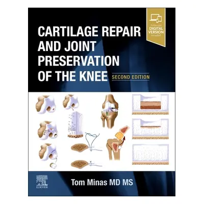 "Cartilage Repair and Joint Preservation of the Knee" - "" ("Minas Tom")(Pevná vazba)