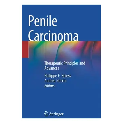 "Penile Carcinoma: Therapeutic Principles and Advances" - "" ("Spiess Philippe E.")(Paperback)