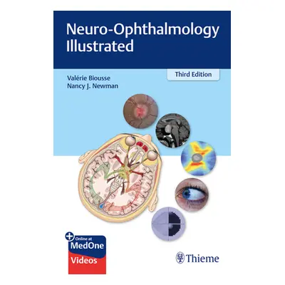 "Neuro-Ophthalmology Illustrated" - "" ("Biousse Valerie")(Paperback)