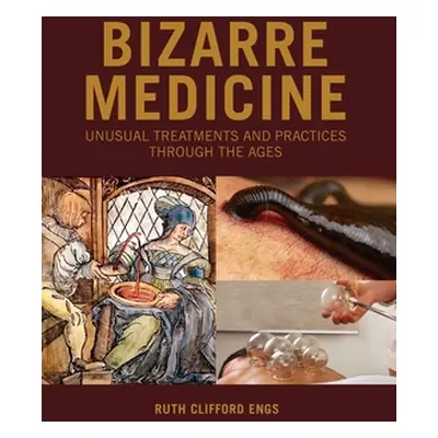 "Bizarre Medicine: Unusual Treatments and Practices through the Ages" - "" ("Engs Ruth Clifford"