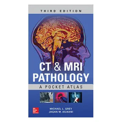 "CT & MRI Pathology: A Pocket Atlas, Third Edition" - "" ("Ailinani Jagan")(Paperback)