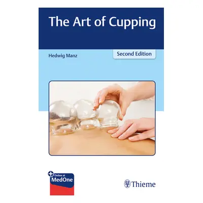 "The Art of Cupping" - "" ("Manz Hedwig")(Paperback)