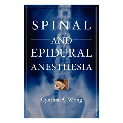 "Spinal and Epidural Anesthesia" - "" ("Wong Cynthia")(Pevná vazba)