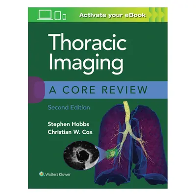 "Thoracic Imaging: A Core Review" - "" ("Hobbs Stephen")(Paperback)