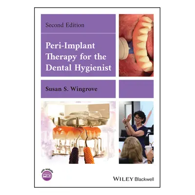 "Peri-Implant Therapy for the Dental Hygienist" - "" ("Wingrove Susan S.")(Paperback)