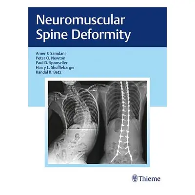 "Neuromuscular Spine Deformity" - "" ("Samdani Amer F.")(Pevná vazba)