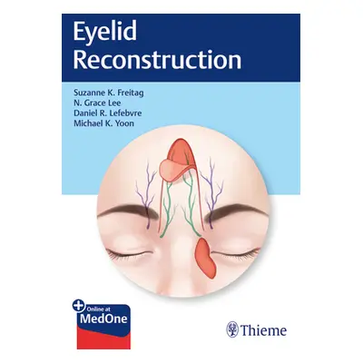 "Eyelid Reconstruction" - "" ("Freitag Suzanne K.")(Pevná vazba)