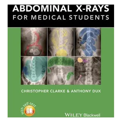 "Abdominal X-Rays for Medical Students" - "" ("Clarke Christopher")(Paperback)