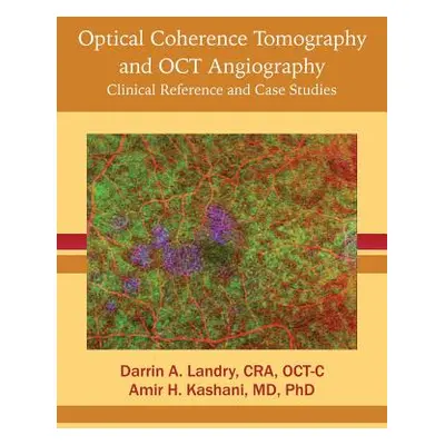 "Optical Coherence Tomography and OCT Angiography: Clinical Reference and Case Studies" - "" ("L