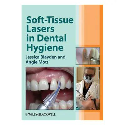 "Soft-Tissue Lasers in Dental H" - "" ("Blayden Jessica")(Paperback)