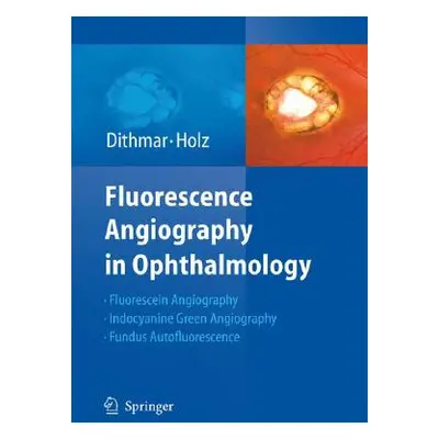 "Fluorescence Angiography in Ophthalmology" - "" ("Dithmar Stefan")(Pevná vazba)