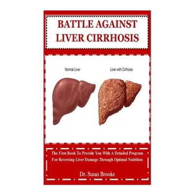 "Battle Against Liver Cirrhosis: The First Book To Provide You With A Detailed Program For Rever