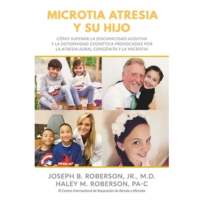 "Microtia Atresia y Su Hijo: Cmo Superar la Discapacidad Auditiva y la Deformidad Cosmtica Provo