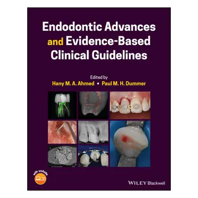 "Endodontic Advances and Evidence-Based Clinical Guidelines" - "" ("Ahmed Hany M. a.")(Pevná vaz