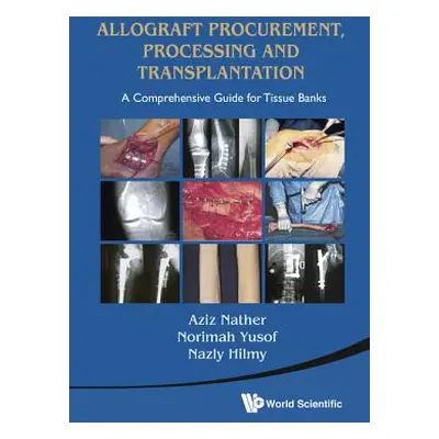 "Allograft Procurement, Processing and Transplantation: A Comprehensive Guide for Tissue Banks" 