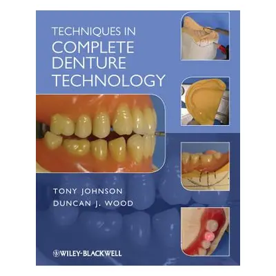 "Techniques in Complete Denture" - "" ("Johnson Tony")(Paperback)